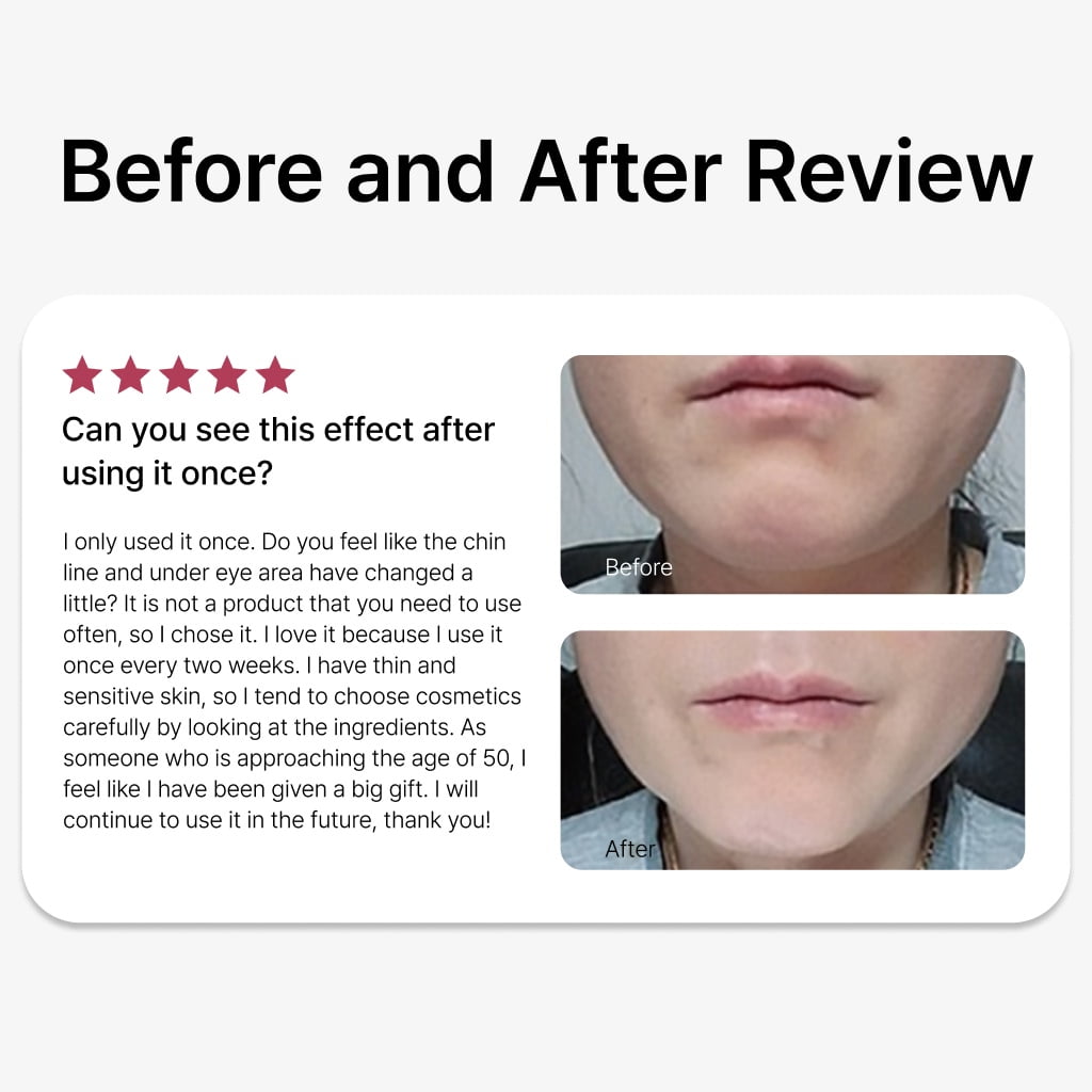 DUALSONIC Professional Gold HIFU Home Care Device – Deep Lifting & Skin Firming Technology