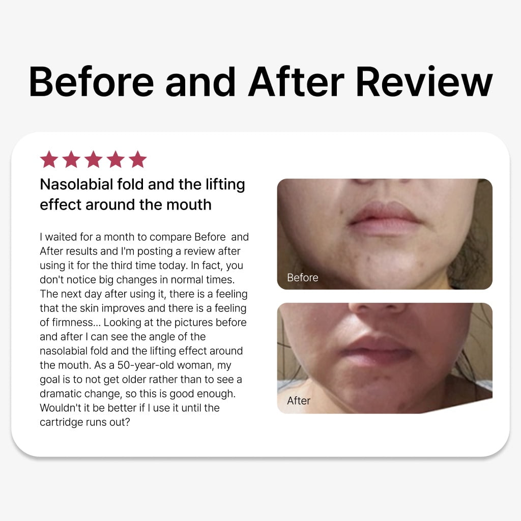 DUALSONIC Professional Gold HIFU Home Care Device – Deep Lifting & Skin Firming Technology